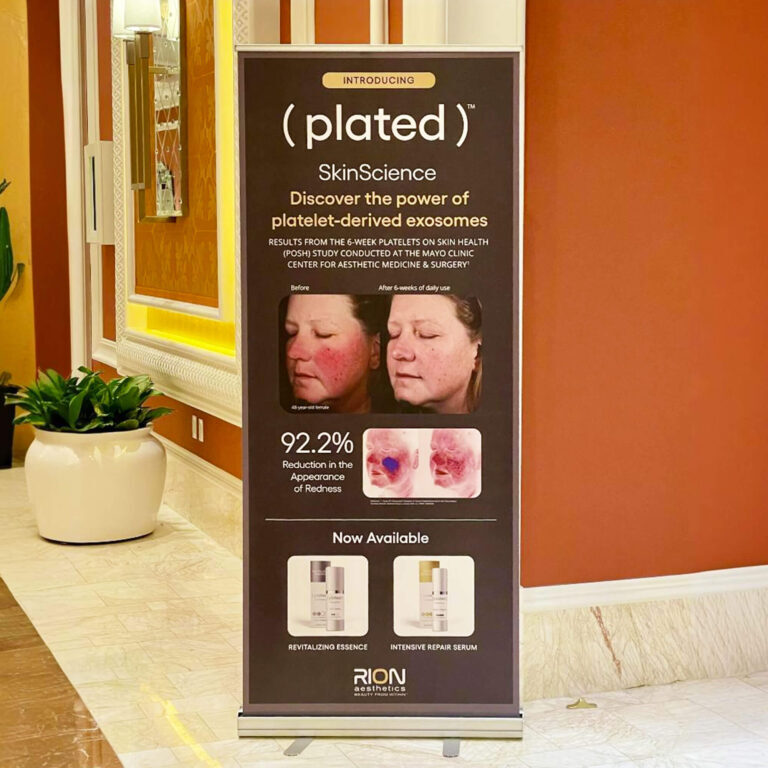 Anley Custom Retractable Banners – Personalized Banners